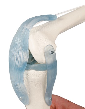 Schupp Kniegelenk Wochenangebot